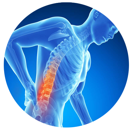 Back Pain Picture Free Photo PNG PNG Image