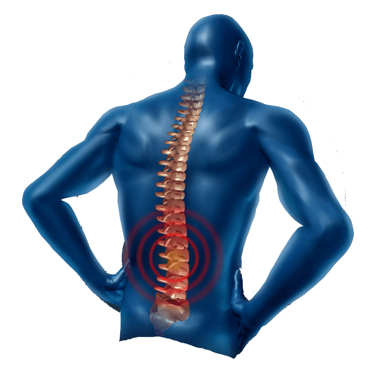 Back Pain Free Download PNG HQ PNG Image